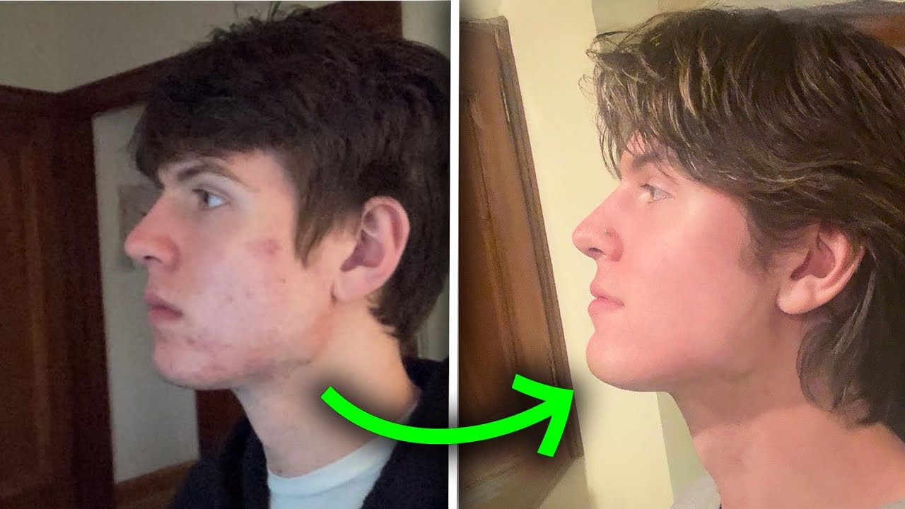 The Ultimate Guide to Achieving a Perfect Jaw: Methods and Insights