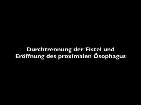 Schmerzen in der Prostata-Krebs Prostatasekretanalysetechnik