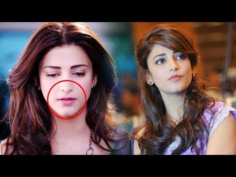 download lagu mp3 mp4 Shruti Hassan Lip Job, download lagu Shruti Hassan Lip Job gratis, unduh video klip Shruti Hassan Lip Job