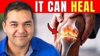 Can Bone-On-Bone Knee Arthritis Actually Heal? Here’s How to Tell