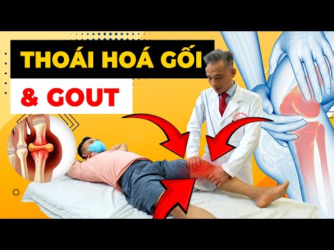 Bạn Đã Mệt Mỏi Vì Gout Và Thoái Hóa Gối? Đây Là Cách Để Sống Không Đau Đớn!