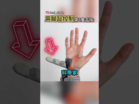 這根機械指竟然產生幻肢痛😱