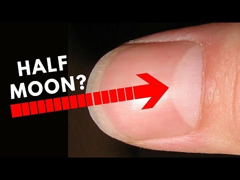 Do You Have Half Moon Shape On Your Nails?? -Palmistry
