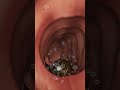 How Your Body Turns Food Into Poop The Digestive Journey Shorts Viralvideo Creativelearning3d