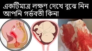 একটিমাত্র লক্ষণ দেখে বুঝে নিন আপনি গর্ভবতী কিনা | Implantation bleeding in Bangla