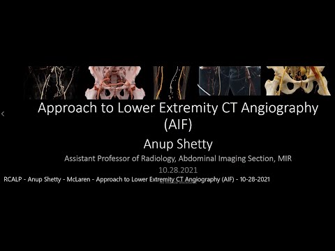 Approach to Lower Extremity CT Angiography (AIF)