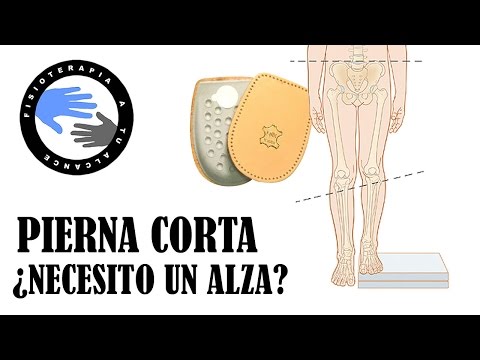 Pierna corta, cuando poner un alza