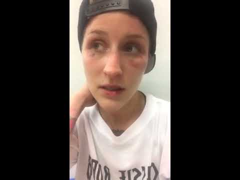 Cassie Robb - RIZIN Post Fight Facebook Live - (2017.07.30) - /r/WMMA