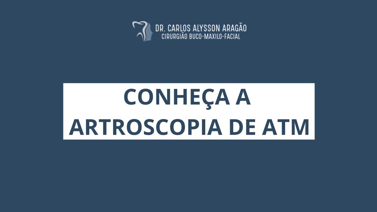 Carlos Alysson Aragão-60