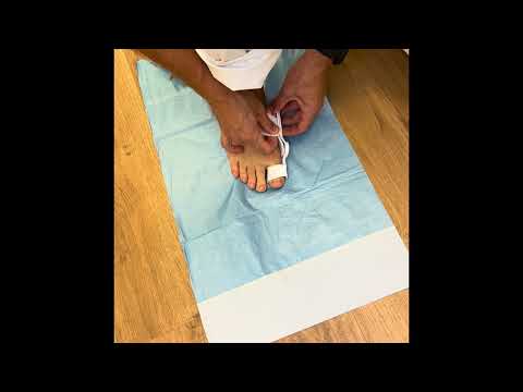 Hallux Valgus erklärt: Woher er kommt und was wirklich hilft