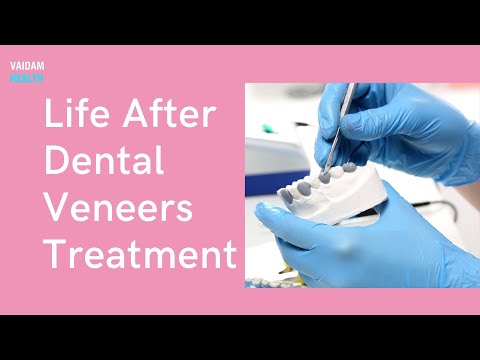 Life After Dental Veneers Treatment
