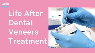 Life After Dental Veneers Treatment