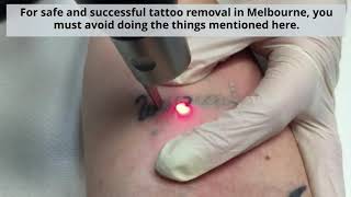 What You Shouldn’t Do Before Your Laser Tattoo Removal Session