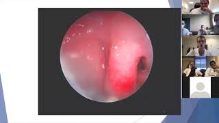 Dysfonctions chroniques de la trompe d'Eustache