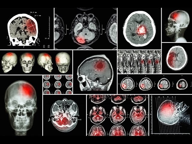 Precision in Imaging: Navigating Radiology Diagnoses