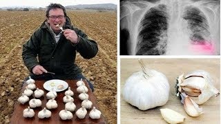 Quest'Uomo Mangiava Aglio Tutti I Giorni E Questo È Quello Che È Successo