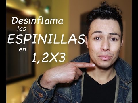 download lagu mp3 mp4 Como Desinflamar Espinillas, download lagu Como Desinflamar Espinillas gratis, unduh video klip Como Desinflamar Espinillas