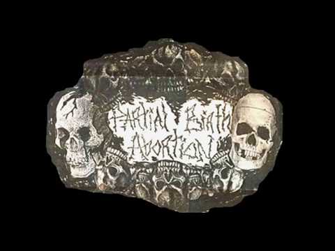 Partial Birth Abortion  S/T demo [2001 Raw Crust/Grindcore/Powerviolence]