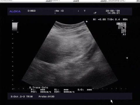 Diagnosi articolazione temporomandibolare Ayurveda circa il mal di schiena