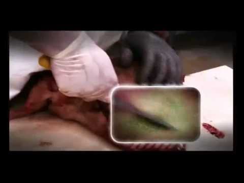 Deutschland 2012 - Unser täglich verseuchtes Fleisch gib uns heute!