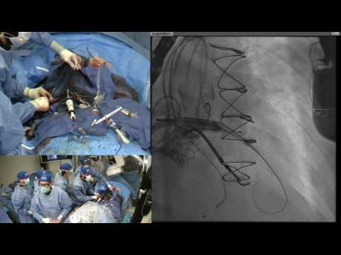 TCT Live 2016   LAMPOON