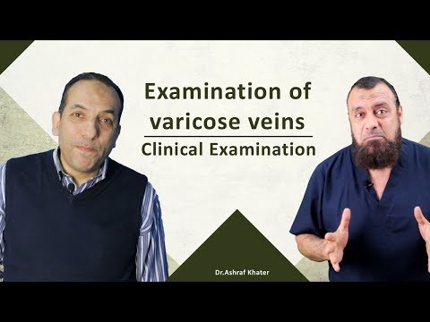 Examination of Varicose Veins