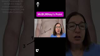 McBurney’s Point Explained | Appendicitis Assessment: Medical Surgical SHORT | @LevelUpRN