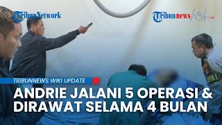 Kondisi Andrie Yunus usai Disiram Air Keras: Perlu 4 Bulan Perawatan dan Operasi Lanjutan
