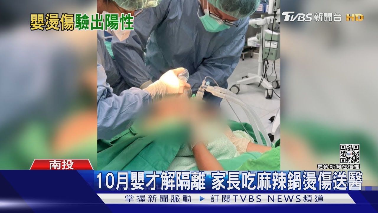 嬰兒身上這燙傷 解隔離吃麻辣鍋燙到的