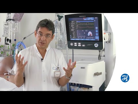 Adaptive Support Ventilation (ASV) - Wie funktioniert es?