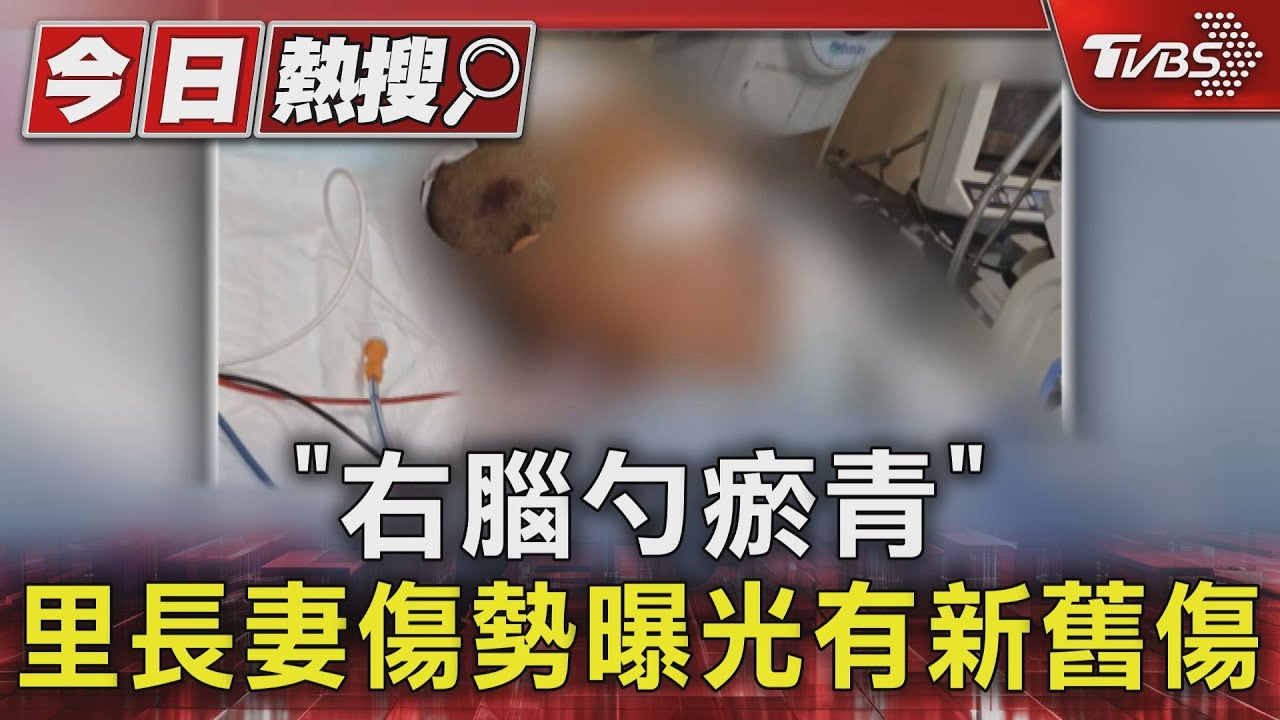 「右腦勺瘀青」 里長妻傷勢曝光有新舊傷