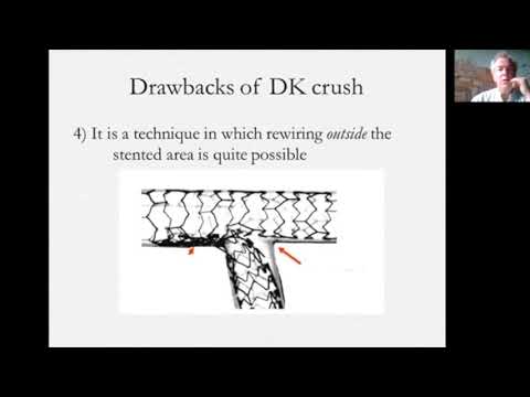 Provisional or reverse provisional T, TAP or Culotte is the best technique - Dr David Hildick-Smith