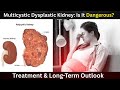 "Multicystic Dysplastic Kidney: Is It Dangerous? | Treatment & Long-Term Outlook#nephrologist