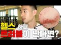 운동하면 피부트러블에 안좋다..? (운동X피부 Q&A /트러블예방 꿀팁)