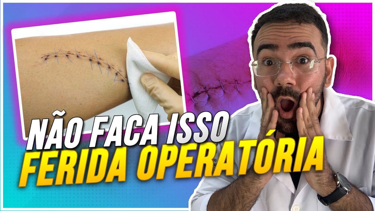 CUIDADO COM A FERIDA OPERATÓRIA! AULA DE FERIDAS E CURATIVOS