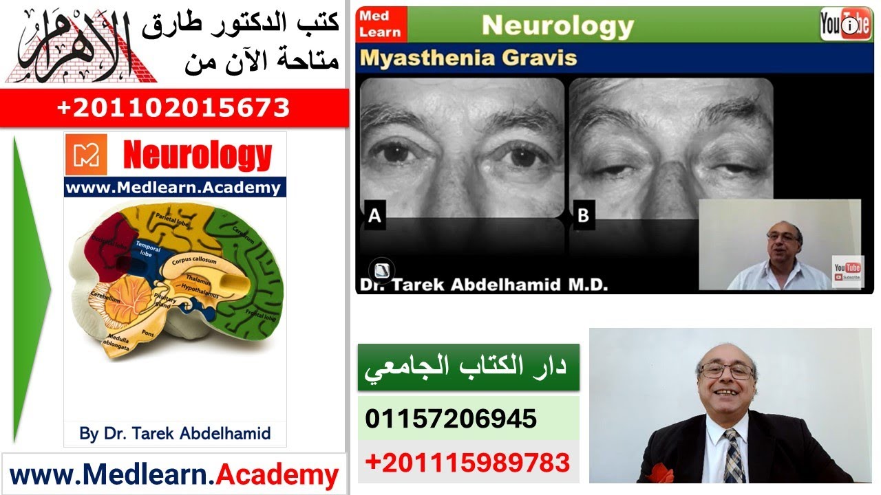 Myasthenia Gravis   #usmle #internal_medicine #cme #medicaleducation #ecg #محاضرات_باطنة #medical