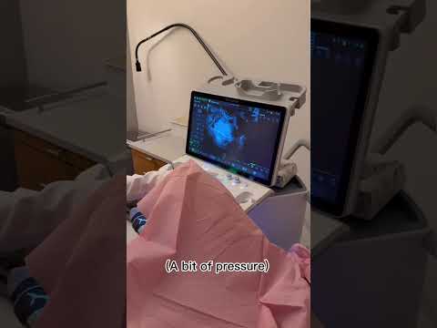 Inside a Fertility Ultrasound