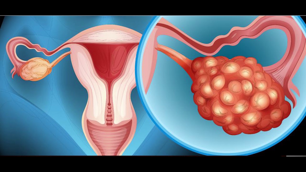 Eliseo Lopez Flores-6