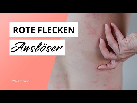 Rote Punkte auf der Haut: Warnsignal oder harmlos?
