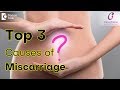 Top 3 Causes of Miscarriage - Dr. Pooja Bansal of Cloudnine Hospitals | Doctors’ Circle