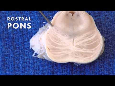 Sensation from the Body: Neuroanatomy Video Lab - Brain Dissections
