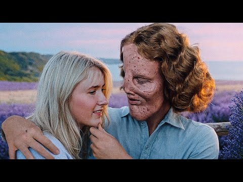 A Blind Girl Chose a Boyfriend Not Knowing What He Really Looks Like