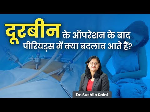 What changes occur in your periods after laparoscopic surgery? Learn the full truth.