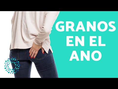 Adiós al dolor: 5 remedios caseros para eliminar el grano en el ano | Actualizado septiembre 2023
