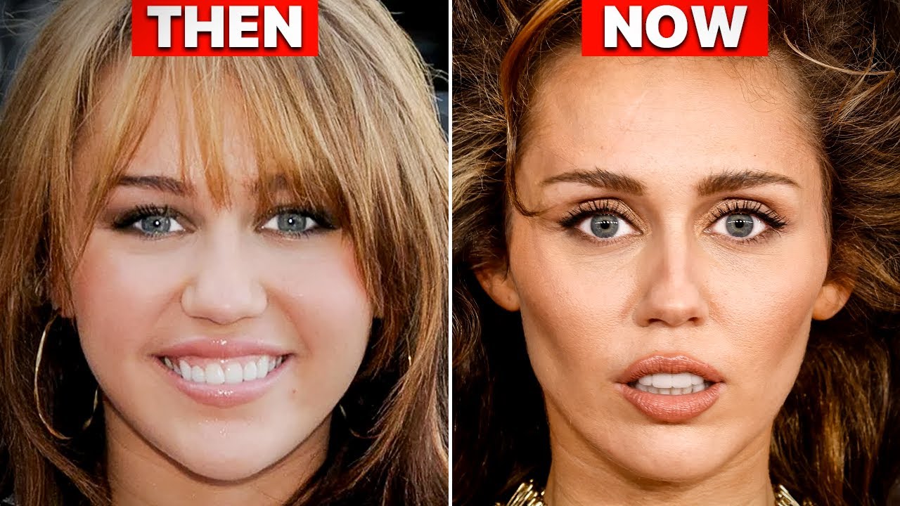 Miley Cyrus NEW Look 2024 Plastic Surgery Analysis
