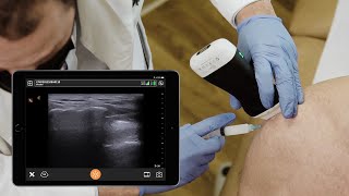 Subacromial Injection