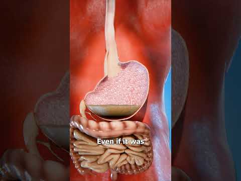 What Happens If You Swallow Mentos And Coke 😨
