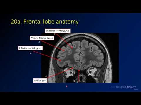 Neuroradiology review - brain gyral anatomy