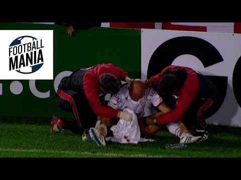 Head Hit and Nosebleed - Maximiliano Gómez (Defensor) vs. Federico Mancinelli (Huracán)