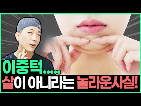 ❌살빼도 이중턱 안없어짐❌  이중턱&무턱 생기는 7가지 이유는? | 7 reasons why you have double chin
